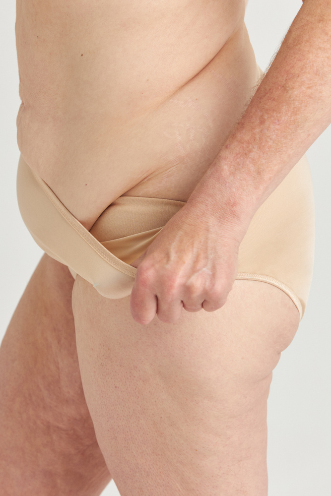 Freedom Skin-Relief Panty